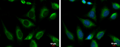 Anti-PRKCSH antibody [N1C1] used in Immunocytochemistry/ Immunofluorescence (ICC/IF). GTX101889