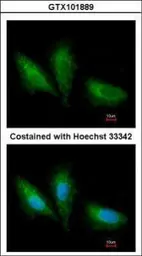 Anti-PRKCSH antibody [N1C1] used in Immunocytochemistry/ Immunofluorescence (ICC/IF). GTX101889