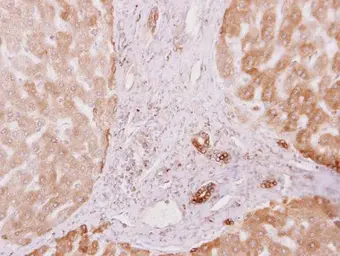 Anti-PRKCSH antibody [N1C1] used in IHC (Paraffin sections) (IHC-P). GTX101889