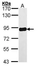 Anti-PRKCSH antibody [N1C1] used in Western Blot (WB). GTX101889