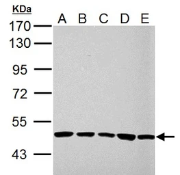 Anti-UQCRC1 antibody used in Western Blot (WB). GTX101896