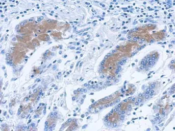 Anti-Annexin II antibody used in IHC (Paraffin sections) (IHC-P). GTX101902