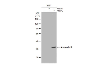 Anti-Annexin II antibody used in Western Blot (WB). GTX101902