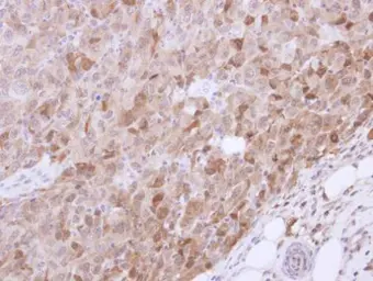 Anti-VGAT antibody [N1N2], N-term used in IHC (Paraffin sections) (IHC-P). GTX101908