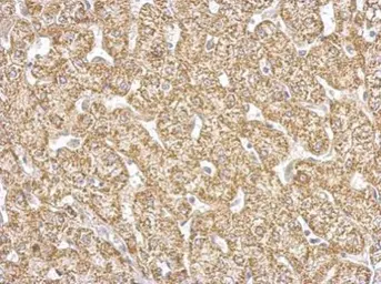 Anti-GOT2 antibody used in IHC (Paraffin sections) (IHC-P). GTX101929