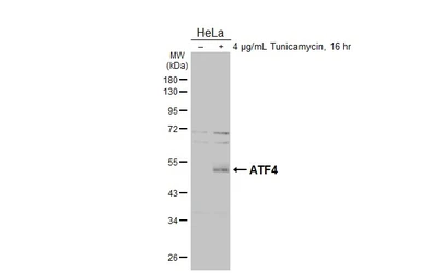 Anti-ATF4 antibody used in Western Blot (WB). GTX101943