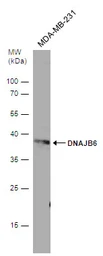 Anti-DNAJB6 antibody [N3C3] used in Western Blot (WB). GTX101947