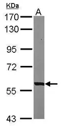 Anti-PHGDH antibody [N1N2], N-term used in Western Blot (WB). GTX101948