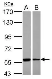 Anti-PHGDH antibody [N3C2], Internal used in Western Blot (WB). GTX101949