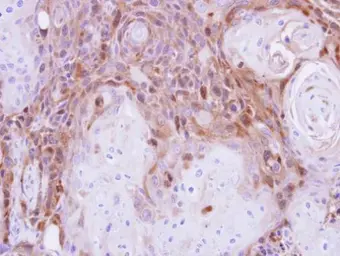 Anti-Peripherin antibody used in IHC (Paraffin sections) (IHC-P). GTX102005