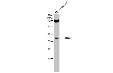 Anti-TRAP1 antibody used in Western Blot (WB). GTX102017