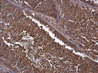 Anti-MCL1 antibody used in IHC (Paraffin sections) (IHC-P). GTX102026