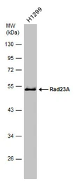 Anti-RAD23A antibody [N3C3] used in Western Blot (WB). GTX102032