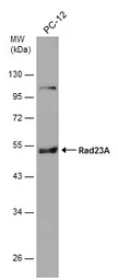 Anti-RAD23A antibody [N3C3] used in Western Blot (WB). GTX102032