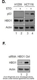 Anti-MYST2 antibody [N2C1], Internal used in Western Blot (WB). GTX102041