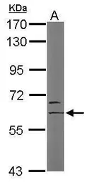 Anti-MYST2 antibody [N2C1], Internal used in Western Blot (WB). GTX102041