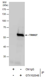 Anti-TRIM27 antibody used in Immunoprecipitation (IP). GTX102048