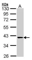 Anti-Transaldolase antibody used in Western Blot (WB). GTX102076