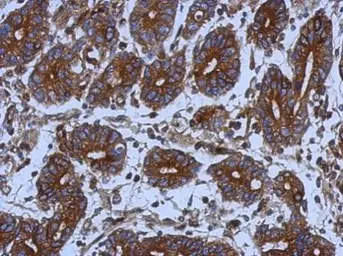 Anti-alpha Tubulin antibody used in IHC (Paraffin sections) (IHC-P). GTX102079