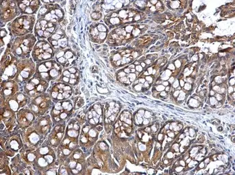 Anti-Lysyl-tRNA synthetase antibody used in IHC (Paraffin sections) (IHC-P). GTX102113