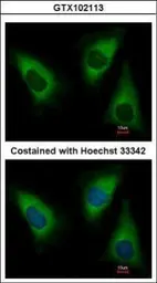Anti-Lysyl-tRNA synthetase antibody used in Immunocytochemistry/ Immunofluorescence (ICC/IF). GTX102113