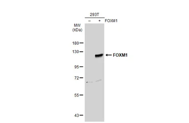 Anti-FOXM1 antibody used in Western Blot (WB). GTX102126