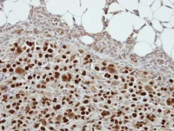 Anti-CIZ1 antibody [N2C1], Internal used in IHC (Paraffin sections) (IHC-P). GTX102144