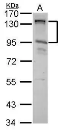 Anti-CIZ1 antibody [N2C1], Internal used in Western Blot (WB). GTX102144