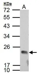 Anti-APOBEC3C antibody used in Western Blot (WB). GTX102164