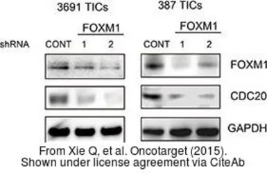 Anti-FOXM1 antibody used in Western Blot (WB). GTX102170