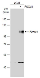 Anti-FOXM1 antibody used in Western Blot (WB). GTX102170