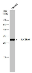 Anti-SLC25A1 antibody [N1C1] used in Western Blot (WB). GTX102191
