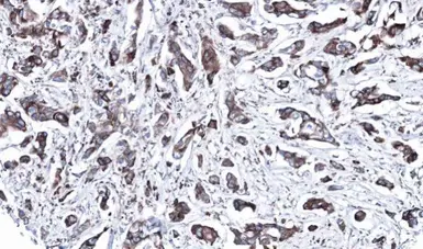Anti-MEK2 antibody [N1C1] used in IHC (Paraffin sections) (IHC-P). GTX102198