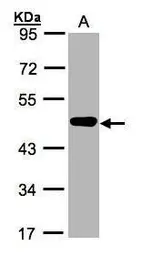 Anti-MEK2 antibody [N1C1] used in Western Blot (WB). GTX102198