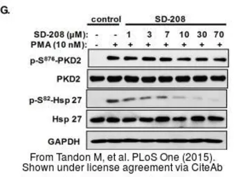 Anti-PKD2 antibody [C1C3] used in Western Blot (WB). GTX102212