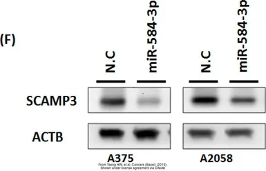 Anti-SCAMP3 antibody [N1N3] used in Western Blot (WB). GTX102216