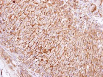 Anti-SCAMP3 antibody [N1N3] used in IHC (Paraffin sections) (IHC-P). GTX102216
