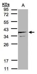 Anti-SCAMP3 antibody [N1N3] used in Western Blot (WB). GTX102216