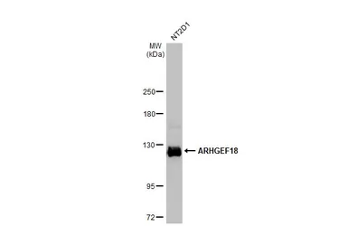 Anti-ARHGEF18 antibody used in Western Blot (WB). GTX102223