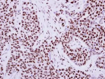Anti-KAP1 antibody [N3C2], Internal used in IHC (Paraffin sections) (IHC-P). GTX102226