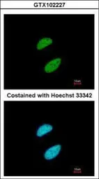 Anti-KAP1 antibody [N1N2], N-term used in Immunocytochemistry/ Immunofluorescence (ICC/IF). GTX102227