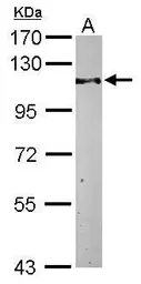 Anti-KAP1 antibody [N1N2], N-term used in Western Blot (WB). GTX102227