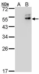 Anti-DPF2 antibody used in Western Blot (WB). GTX102235