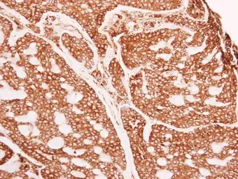 Anti-alpha Glucosidase II antibody [N1N2], N-term used in IHC (Paraffin sections) (IHC-P). GTX102237