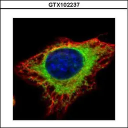 Anti-alpha Glucosidase II antibody [N1N2], N-term used in Immunocytochemistry/ Immunofluorescence (ICC/IF). GTX102237