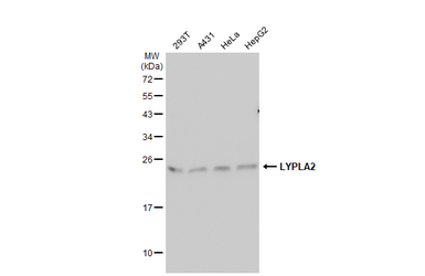Anti-LYPLA2 antibody [N1C3] used in Western Blot (WB). GTX102240