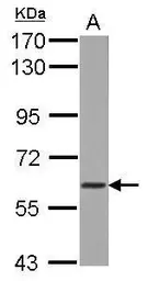 Anti-WDR1 antibody used in Western Blot (WB). GTX102247