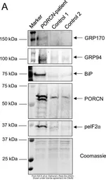 Anti-ORP150 antibody [C2C3], C-term used in Western Blot (WB). GTX102255