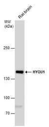 Anti-ORP150 antibody [C2C3], C-term used in Western Blot (WB). GTX102255