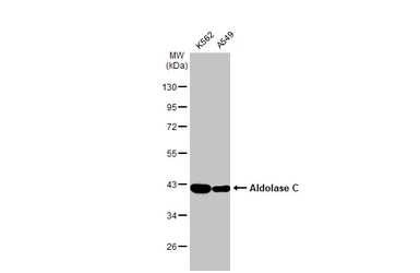 Anti-Aldolase C antibody [N1C1] used in Western Blot (WB). GTX102284